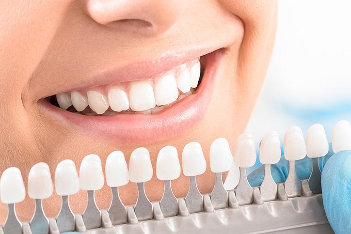 Wybielone zęby
